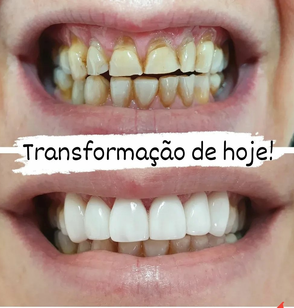 antes e depois